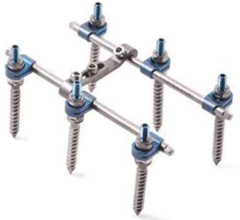 Транспедикулярна система фіксації хребта з 6 напівсферичними поліаксіальними гвинтами "Tria"